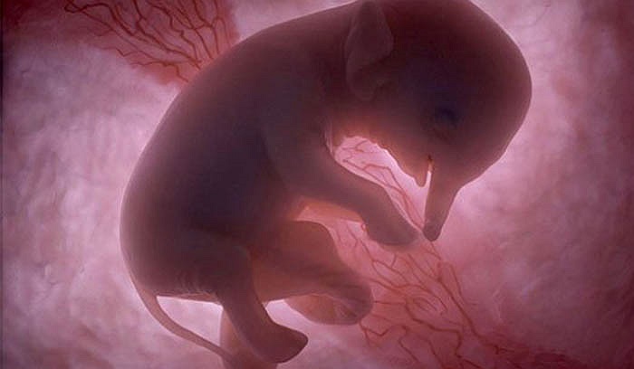 Có thể thấy chiếc vòi nhỏ cũng đã hình thành cùng với cả những chi tiết nhỏ như móng chân. Không như con người, voi sơ sinh sẽ giữ tỉ lệ cơ thể đến khi trưởng thành.