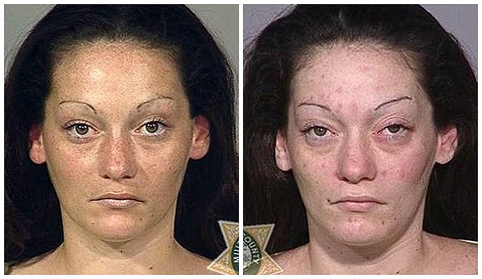 Khuôn mặt thay đổi rõ rệt của một cô gái sau một năm sử dụng ma túy