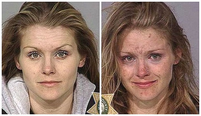 Không thể tin được chỉ sau 8 tháng nghiện ngập, khuôn mặt cô gái này lại trở nên tồi tệ như vậy