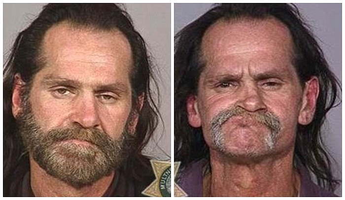 Sau nhiều năm sử dụng ma túy, người đàn ông đã bị rụng răng và gương mặt bị biến dạng