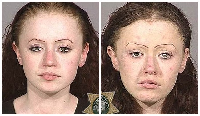 Những vết sẹo đã hủy hoại gương mặt đẹp của cô gái