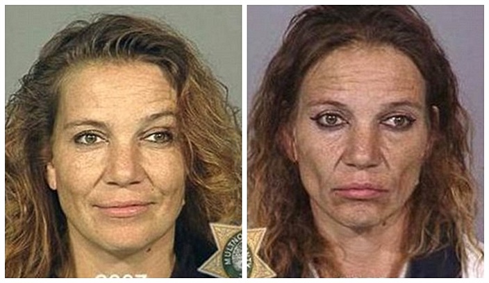 Gương mặt thiếu sức sống thế chỗ cho vẻ đầy đặn trước đây của người phụ nữ