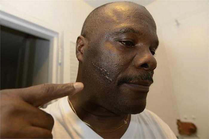 Tuy nhiên, khi ông vừa nhấn xả nước xong thì bỗng chiếc bồn cầu phát nổ, khổ chủ bị chấn thương bất tỉnh, máu chảy ra xung quanh ông.