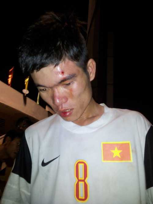 Fan SLNA bị đánh