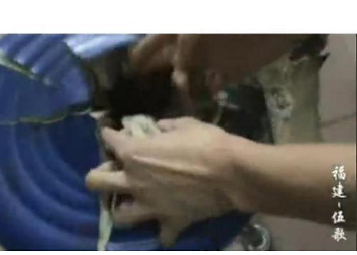 Hậu quả khiến bệnh nhân bị chấn thương nặng ở phần dưới cơ thể, ốc vít và một vài mảnh sắt dài găm vào vùng bụng. 