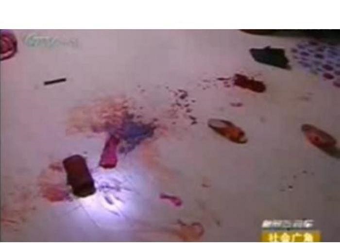 Hình ảnh máu me của bệnh nhân 14 tuổi chảy khắp sàn nhà.