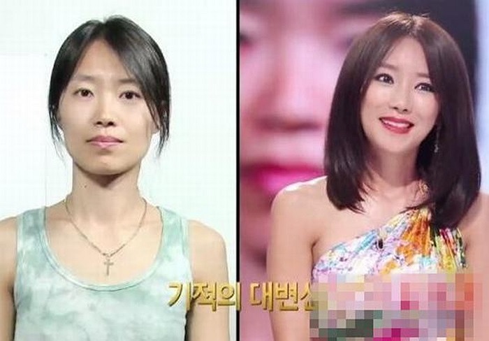 Gái xấu cũng trở nên xinh đẹp nhờ phẫu thuật thẩm mỹ