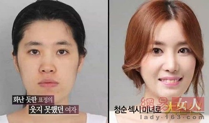 Chỉ cần thay đổi một vài điểm trên khuôn mặt, cô gái đã xinh đẹp hơn rất nhiều