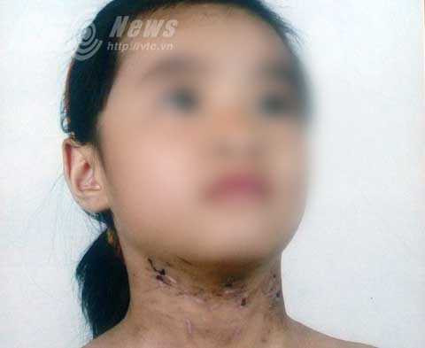 xã Phạm Mệnh, huyện Kinh Môn, bạo hành, 'dì ghẻ', Hải Dương, khởi tố