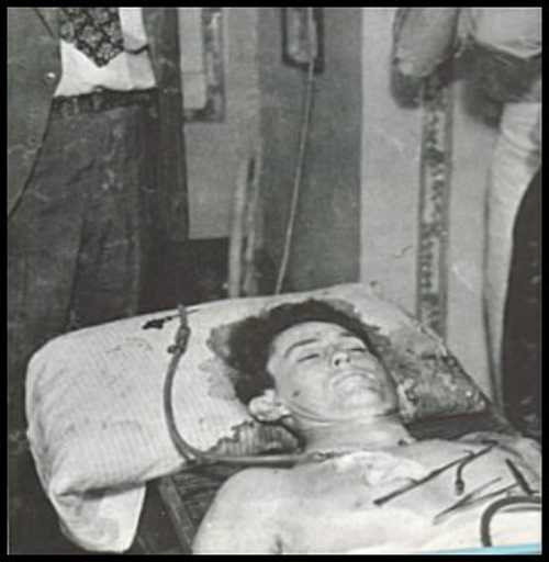 Nghi vấn Lý Tiểu Long bị ám sát bằng độc dược