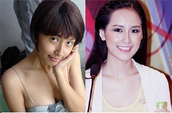 Nhưng người đẹp đã có một cuộc 'lột xác' nhờ các phương pháp làm đẹp như tắm trắng, niềng răng...