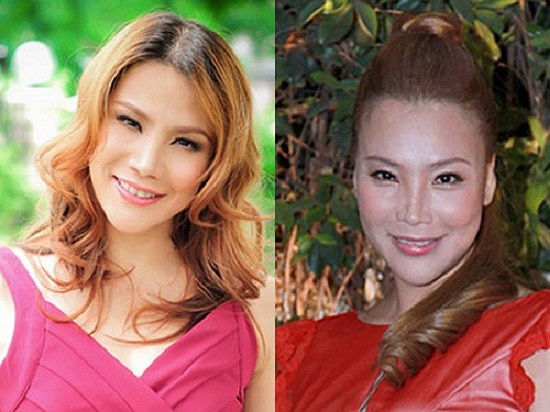 Cuối cùng, Hồ Quỳnh Hương nhờ đến sự can thiệp của dao kéo.