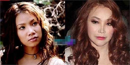 Nhưng không dừng lại ở đó, Hồ Quỳnh Hương tiếp tục dao kéo gương mặt.