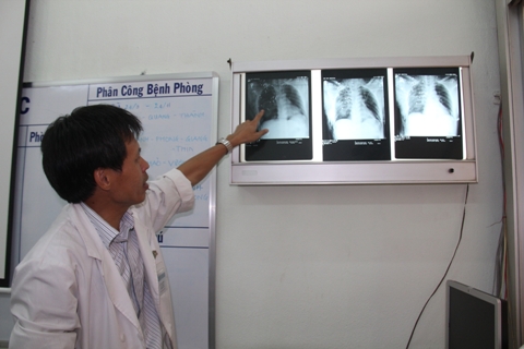 TP.HCM, Sài Gòn, bệnh viện Chợ Rẫy, đạn hoa cải, súng, đi săn.