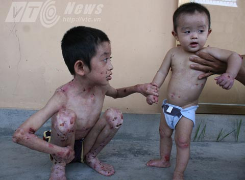 'giời đày', Ly thượng bì bóng nước, Thủy Nguyên, Hải Phòng