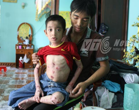 'giời đày', Ly thượng bì bóng nước, Thủy Nguyên, Hải Phòng