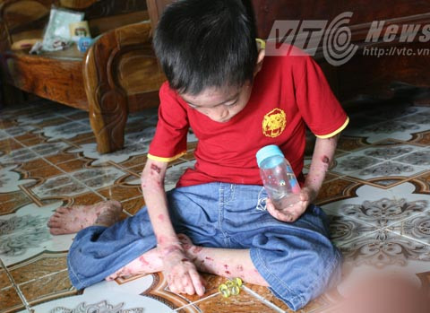 'giời đày', Ly thượng bì bóng nước, Thủy Nguyên, Hải Phòng