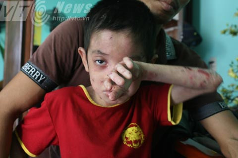 'giời đày', Ly thượng bì bóng nước, Thủy Nguyên, Hải Phòng