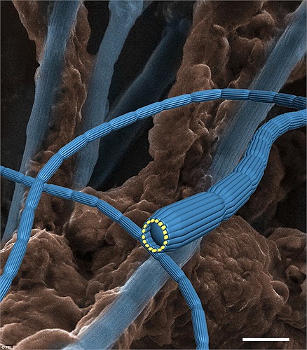 Cận cảnh của vi khuẩn qua kính hiển vi