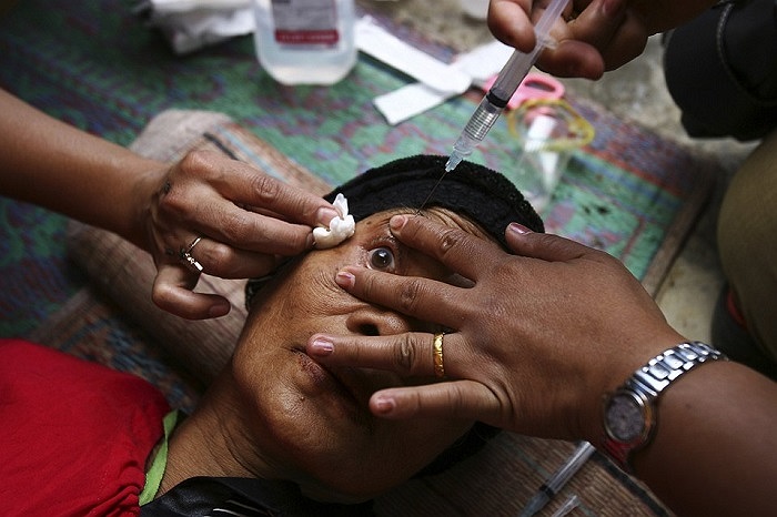 Y tá đang làm sạch mắt cho một người dân Indonesia sau khi chịu bụi từ núi lửa mới phun trào Sinabung.