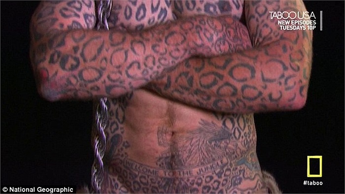 Trên từng cm cơ thể, từ tay đến chân của Larry đều có vệt đốm