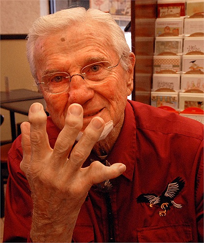  VĐV bóng bầu dục Chuck Bednarik với đôi bàn tay nhăn nhúm