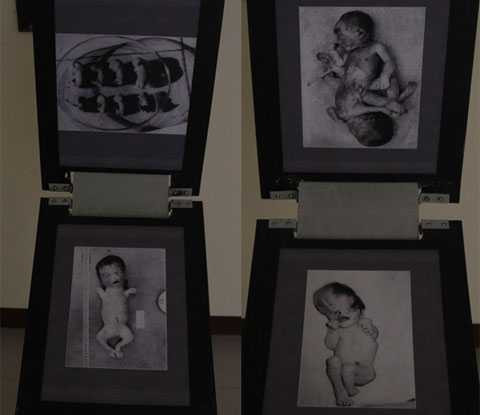 nạn nhân da cam, dioxin, triển lãm, thảm họa