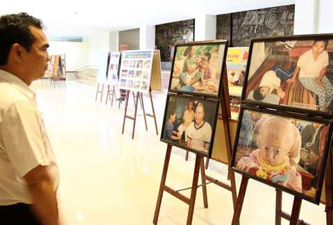 nạn nhân da cam, dioxin, triển lãm, thảm họa