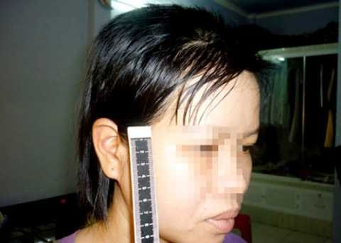 bác sĩ, đánh vợ, sảy thai, Cần Thơ