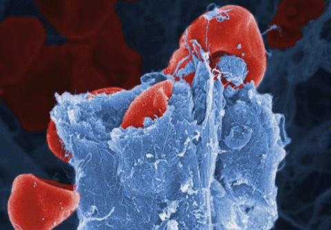 Kiểm tra tốc độ lưu thông máu