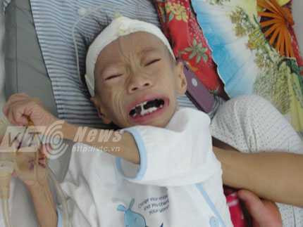 Bạn đọc rơi lệ hướng về bé 3 tuổi trơ xương