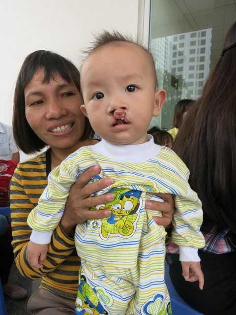 Bệnh viện Vinmec: Phẫu thuật nụ cười cho trẻ em