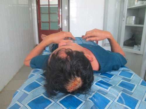 nhân viên nhà xe đánh chết người