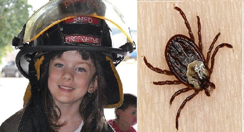 Emille mắc bệnh sốt màng não miền núi sau khi bị bọ chét đốt