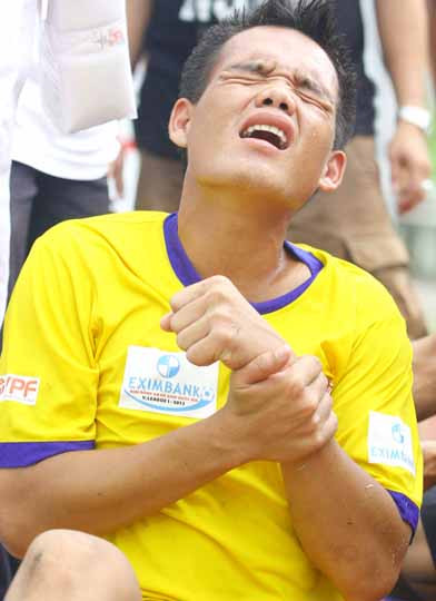 Phúc Hiệp gãy xương đòn