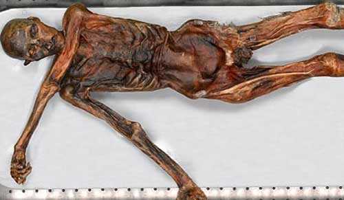 Người băng Otzi. 