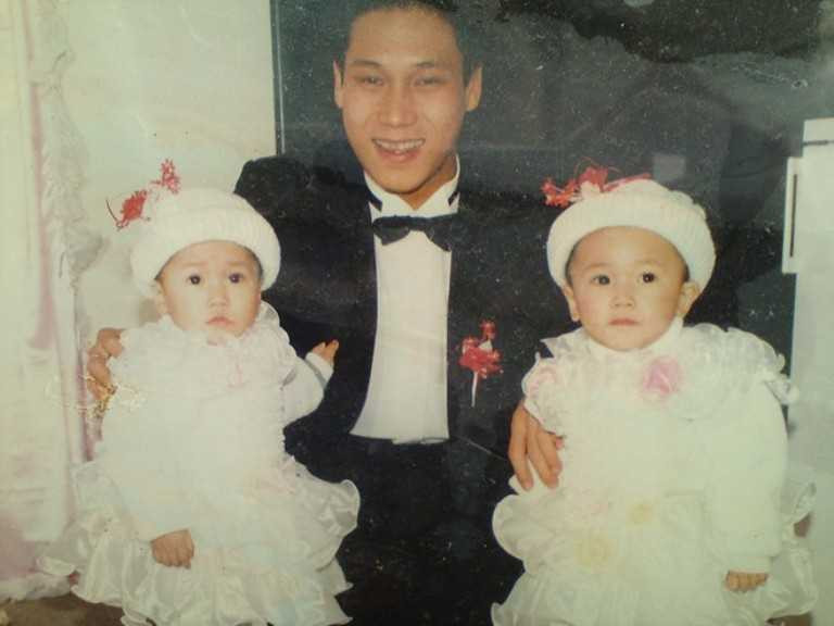 Cặp song sinh ngày nhỏ.