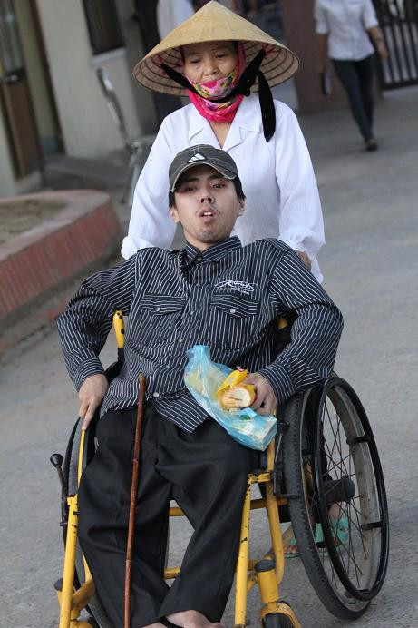 Nguyễn Văn Vọng, khuyết tật đặc cách vào đại học