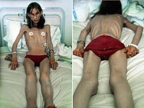 Hiện tại Helen chỉ sống thêm được vài tháng