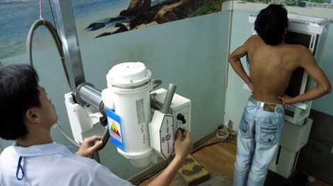 chụp A-quang, bức xạ, hạt nhân, Cục ATBXHN, TP Hồ Chí Minh