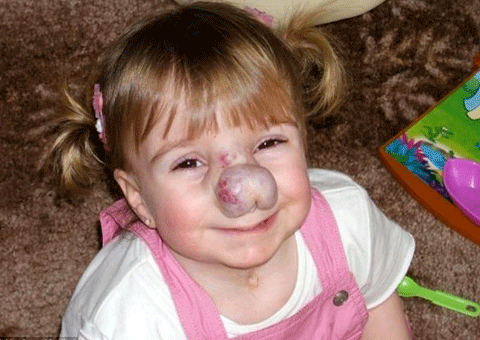 Khi Zoe 18 tháng tuổi