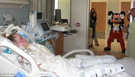 Cô gái trẻ tưởng bị cúm hóa ra phải cắt cụt tứ chi