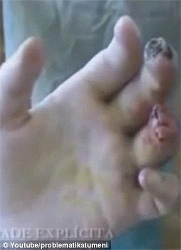 Theo Trung tâm Kiểm soát chất độc Banner, Mỹ, Krokodil có đặc tính gây nghiện mạnh, khi tiêm chất này vào cơ thể, phần da thịt của người nghiện sẽ bị huỷ hoại từ bên trong và giống như da cá sấu.