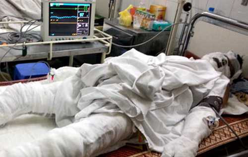 công nhân, điện giật, đào vỉa hè, ngành điện, sai phạm