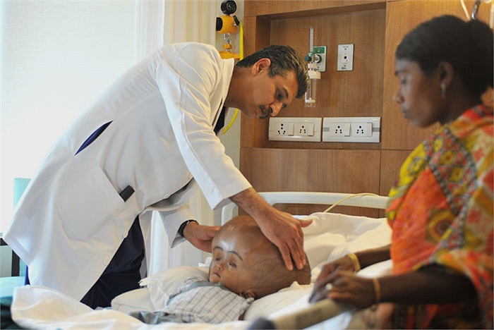 Viện nghiên cứu quốc gia về rối loạn thần kinh và đột quỵ của chính phủ Mỹ ước tính có khoảng 1/500 trẻ em bị não úng thủy.