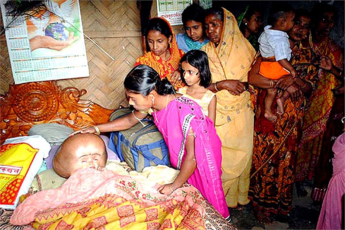 Trong khi mang thai mẹ của cô bé đi khám 2 lần khi thai được 1 tháng và 6 tháng.