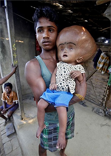 Cha cô bé, anh Abdul Rahman (18 tuổi), chỉ kiếm được 150 rupee (2,75USD một ngày) nhờ làm việc trong lò gạch.