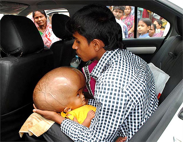 Gia đình cô bé nhận được khoản tài trợ của Fortis Foundation đưa em đi chữa bệnh.