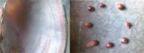 Một con trai "khổng lồ", nặng hơn 1 kg, có tới 16 viên ngọc