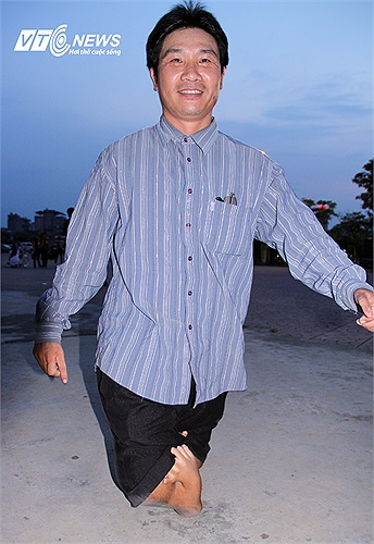 Người đàn ông này chỉ may mắn hơn Nick là có đôi tay và một chút bàn chân.